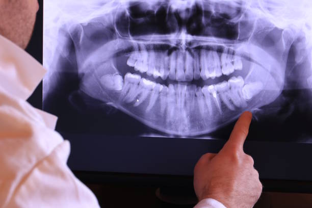 Best Emergency Treatment for Toothache in Energy, IL