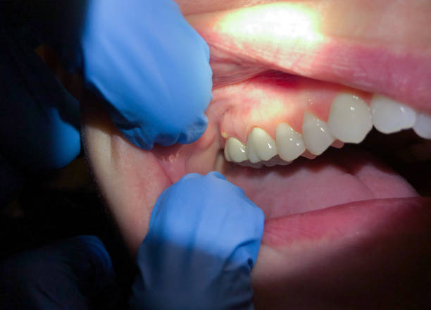 Best Same-Day Emergency Dentist in Energy, IL