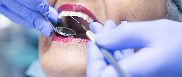 Best Emergency Tooth Extraction in Energy, IL